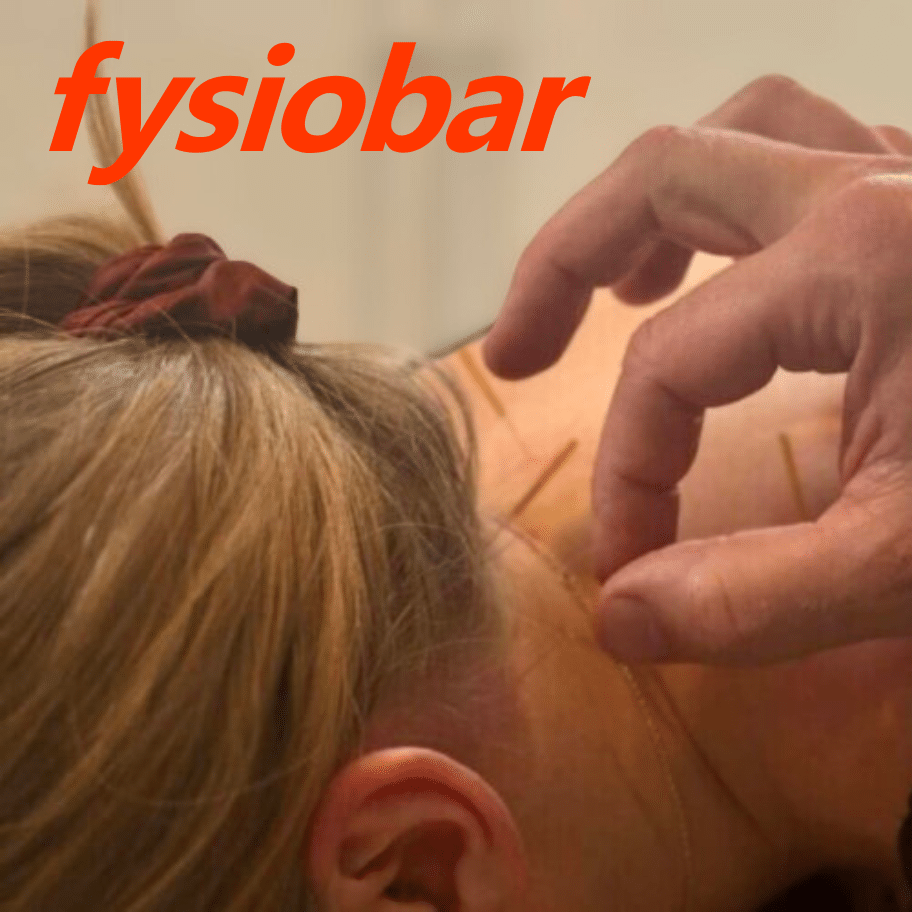 Physiobar | Dry Neeling acupuncture, Oulu 90min